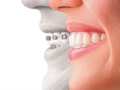 The image features a split-screen comparison with two individuals  on the left side, there s an adult showing a healthy set of teeth, while on the right side, a child s face is shown with a different dental arrangement.