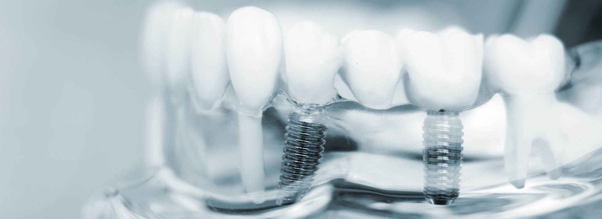 The image shows a close-up view of multiple toothbrushes with bristles, placed against a blurred background that appears to be illuminated by a light source.