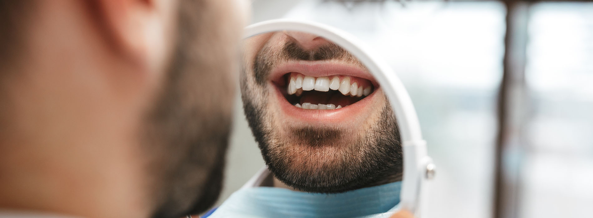 The image shows a close-up view of a person with an open mouth, displaying their teeth, while looking directly at the camera.