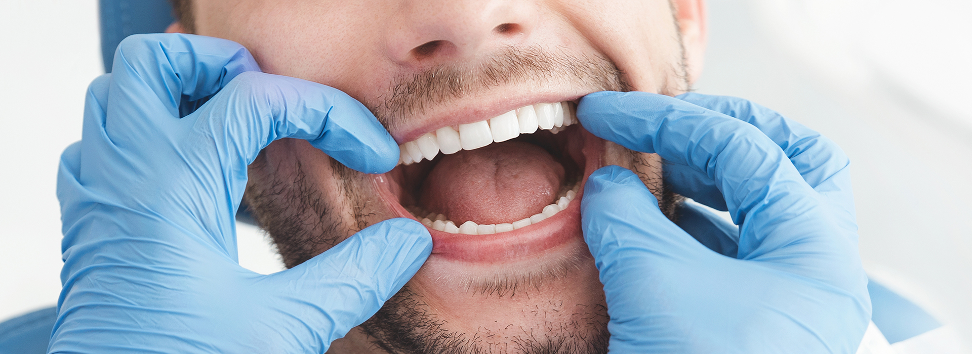 The image shows a man with his mouth wide open, possibly in mid-speech or laughter, wearing blue surgical gloves and holding his hands up near his face.